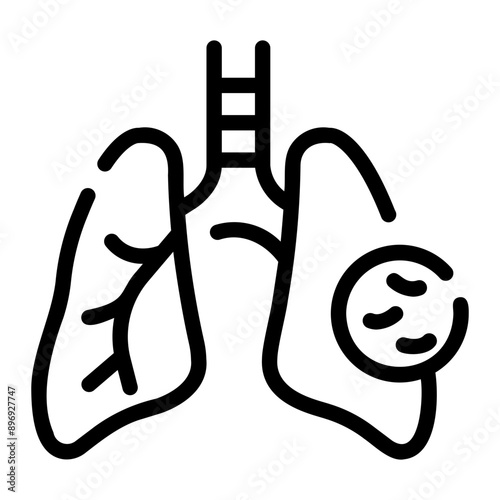 tuberculosis