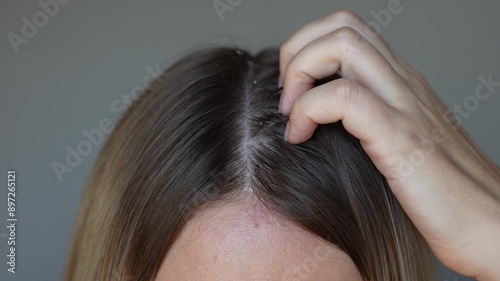 Young blonde woman applying essential cosmetic burdock oil with a dropper and rubbing it into the scalp with hands to strengthen, activate hair growth and reduce hair loss on a dark grey background photo