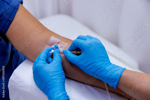 A patient with serum administered in the hospital. Serum is given to the patient. The serum that the nurse makes to her patient. While the doctor opens a vascular access to the patient. photo