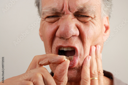 Man holding up and demonstrating his chipped tooth between his fingers.