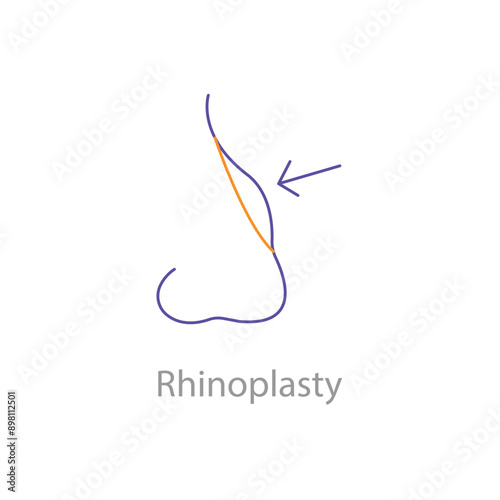 Rhinoplasty, Nose Surgery, Nose Job, Nose Reshaping, Cosmetic Surgery, Facial Surgery, Rhinoplasty Icon, Rhinoplasty Vector, with editable stroke.