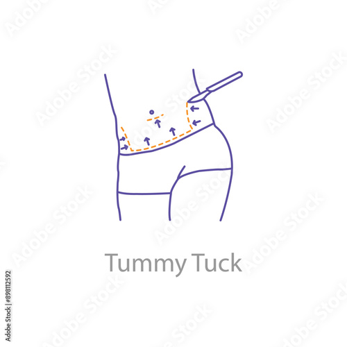  Tummy Tuck, Abdominoplasty, Stomach Surgery, Cosmetic Surgery, Body Contouring, Tummy Tuck Icon, with editable stroke.