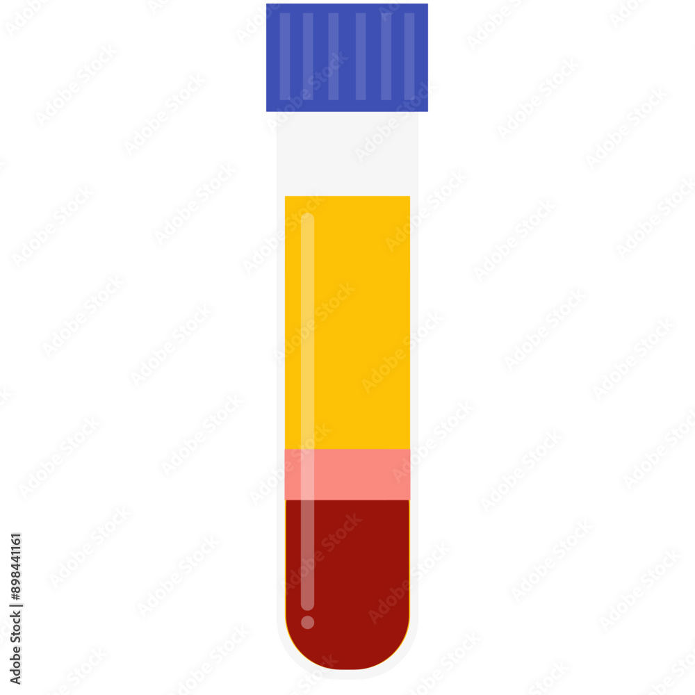 test tube with blood plasma. Blood plasma donation Illustration.