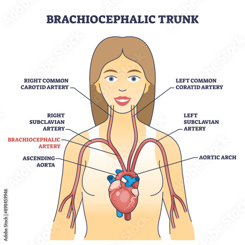 Brachiocephalic trunk anatomy with innominate blood artery outline diagram, transparent background. Labeled educational medical scheme.