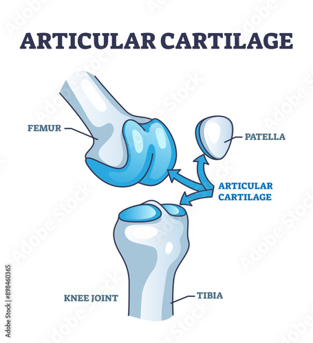 Articular cartilage structure and location in knee joint outline diagram, transparent background. Labeled educational scheme with femur, tibia and patella parts illustration.