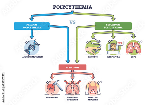 Polycythemia or erythrocytosis as red cells overproduction and increased blood mass outline diagram, transparent background. Labeled educational scheme with primary.
