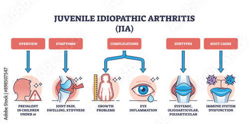 Juvenile idiopathic arthritis or JIA ad children disease outline diagram, transparent background. Labeled educational scheme with medical condition for kids with joint pain.