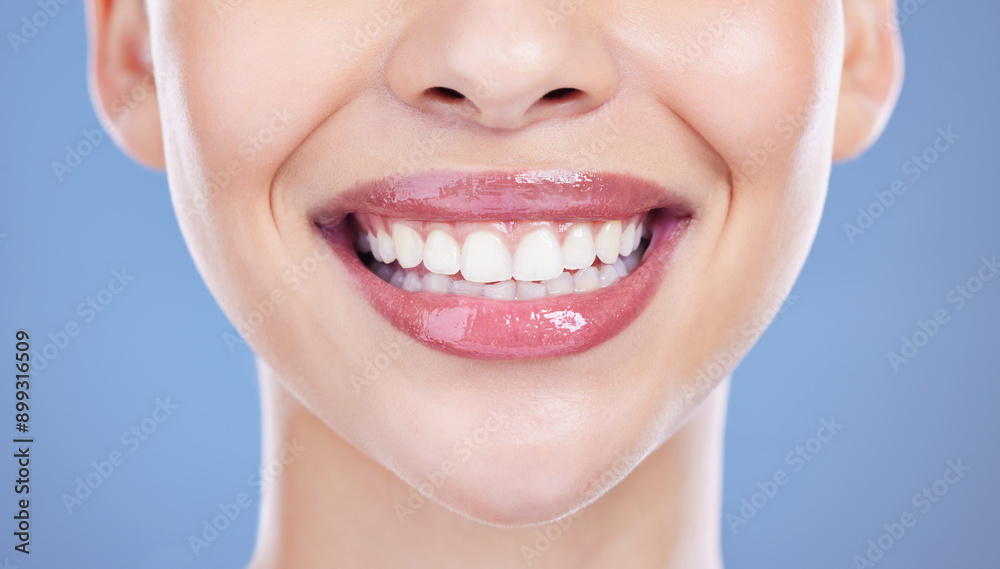 Woman, smile and teeth in studio for dental wellness with hygiene, health and oral transformation. Model, mouth and orthodontics for fresh breath, healthy gums and isolated by blue background Woman, smile and teeth in studio for dental wellness with hygiene, health and oral transformation. Model, mouth and orthodontics for fresh breath, healthy gums and isolated by blue background