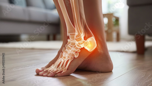 An illustration showing the skeletal structure of a human foot, highlighting a painful area, possibly indicating inflammation or injury in the heel.