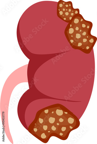 Kidney disease Illustration
