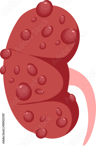 Kidney disease Illustration