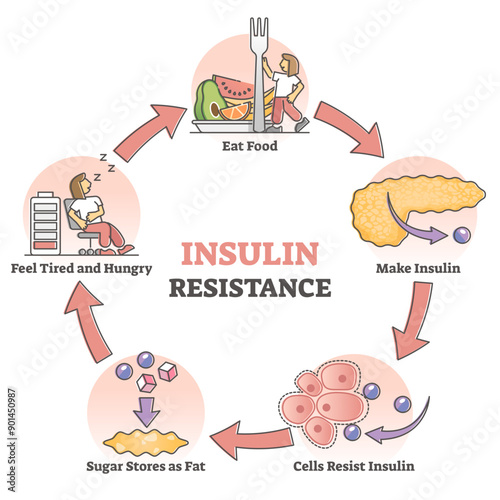 Insulin resistance pathological health condition in educational outline diagram, transparent background.Labeled cycle scheme with anatomical explanation of process illustration.