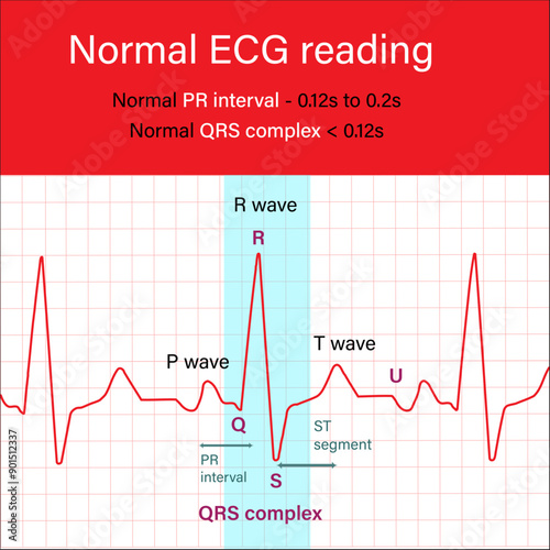 Normal ECG reading Cardiogram PR interval QRS complex