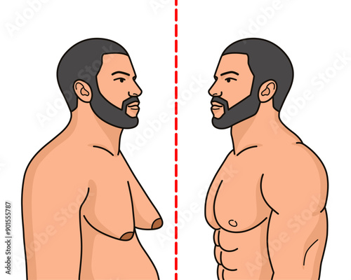 transformation of men's chests, from super saggy chests to muscular and very firm chests