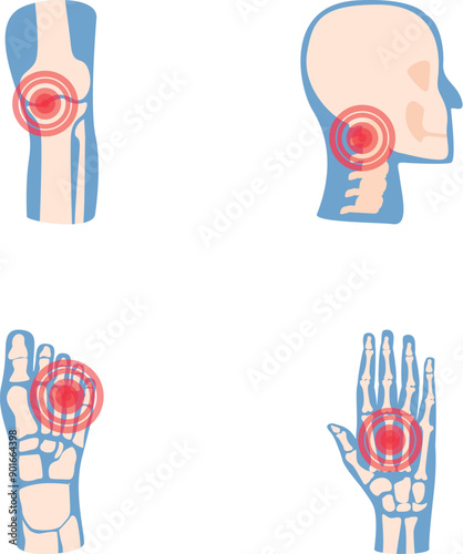 Joint disease icons set cartoon vector. Human joint with red pain ring. Rheumatology, medicine