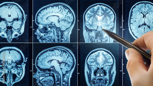 Εκτύπωση καμβά CT scan with brain and doctor's hand