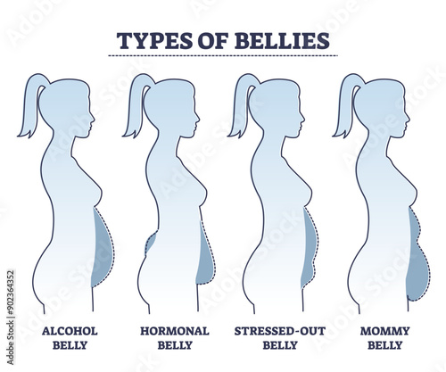 Types of bellies with abdominal fat problem in stomach area outline diagram, transparent background. Collection with various body shape examples and labeled causes set illustration.