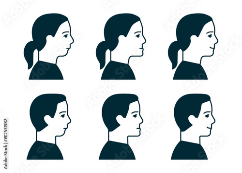 Bite normal jaw and malocclusion, face man an woman in profile set. Dental problem. Wrong bite, lower jaw extended forward and retracted. Bite correction. Vector illustration