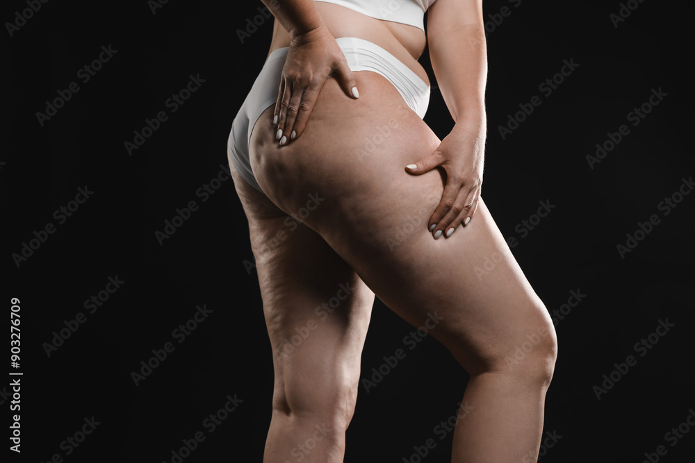 Naklejka premium Woman with cellulite on black background, closeup