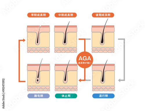AGAヘアサイクル線