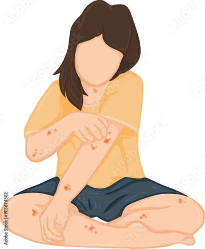 A cartoon drawing of a woman scratching her itchy skin and developing a rash, which is caused by an allergic reaction.  Vector illustration.