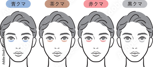 目の下のクマの種類（男性）
