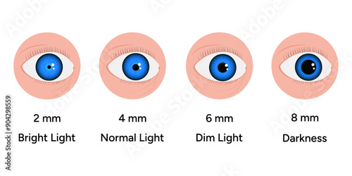 Pupil size changes by Refraction eye ophthalmology, medical illustration