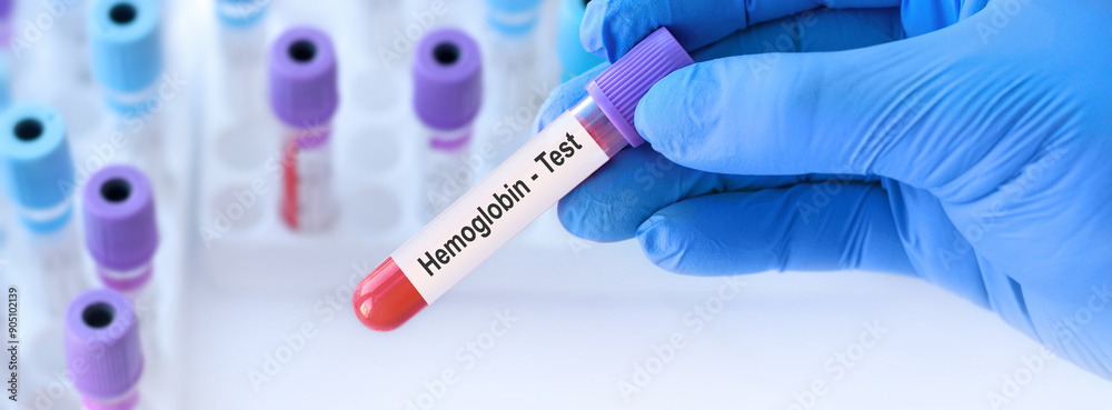 Doctor holding a test blood sample tube with Hemoglobin test on the background of medical test tubes with analyzes. Banner