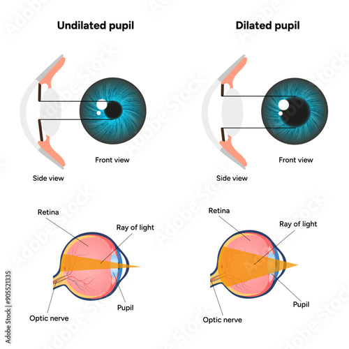 Pupil size in different lighting, Dilated pupil
and Undilated pupil  with Eye anatomy ophthalmology diagram 