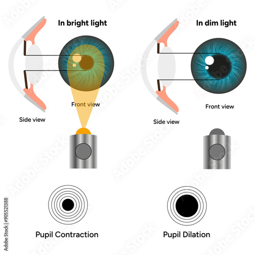 Pupil size in different lighting, Dilated pupil
and Undilated pupil  with ophthalmology diagram 