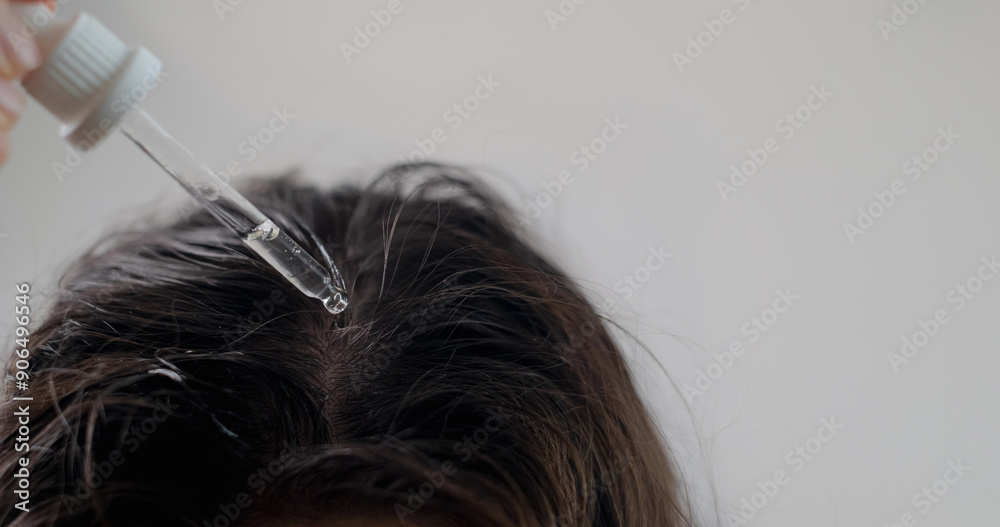 Cosmetologist performing a scalp treatment with hair growth oil, promoting healthier and stronger hair development. Cosmetologist performing a scalp treatment with hair growth oil, promoting healthier and stronger hair development.