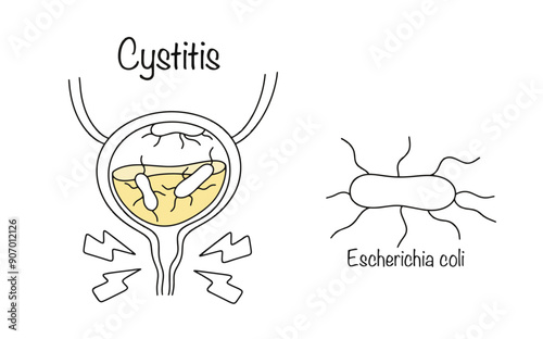 Escherichia coli
