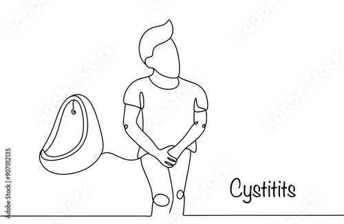 Male cystitis