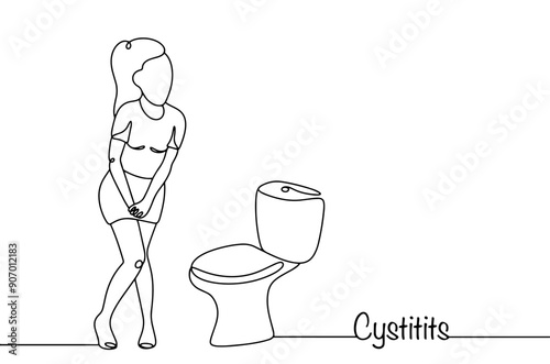 Female cystitis