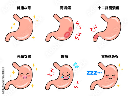 綺麗な胃腸と十二指腸潰瘍と胃潰瘍のイラスト素材セット2