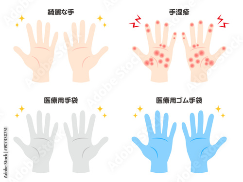 綺麗な手と手湿疹と医療用ゴム手袋のイラスト素材セット