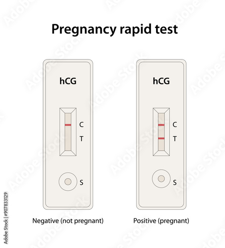 Pregnancy rapid diagnostic test