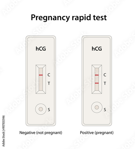 Pregnancy rapid diagnostic test photo