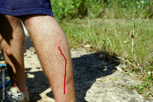 Minor injuries during outdoor activities: photo of a man's legs with a bleeding small cut on the calf, taken against the background of a road and grass. photo