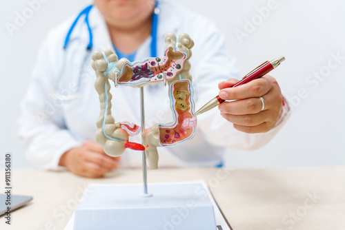 A doctor holds a human colon anatomy model, demonstrating the digestive system's structure to diagnose and treat various gastrointestinal diseases and conditions. photo