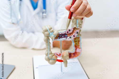 A doctor holds a human colon anatomy model, demonstrating the digestive system's structure to diagnose and treat various gastrointestinal diseases and conditions. photo