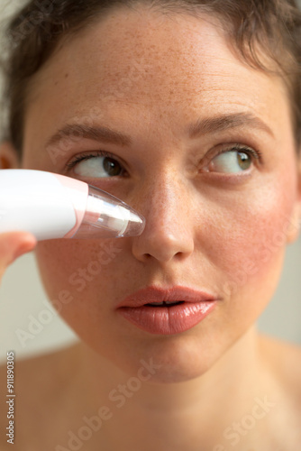 Using blackhead remover