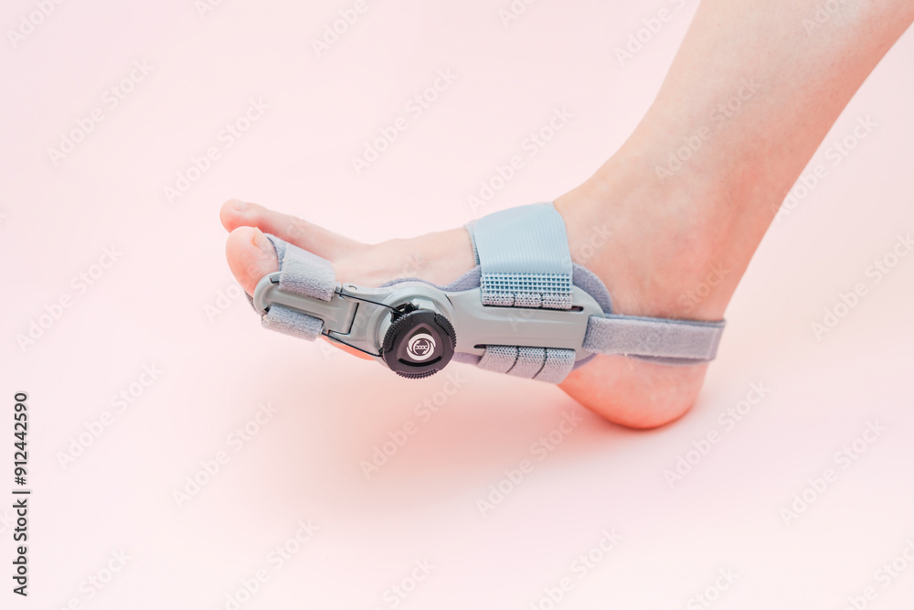 Hallux valgus orthopedic medical thumb brace with adjustment on female foot