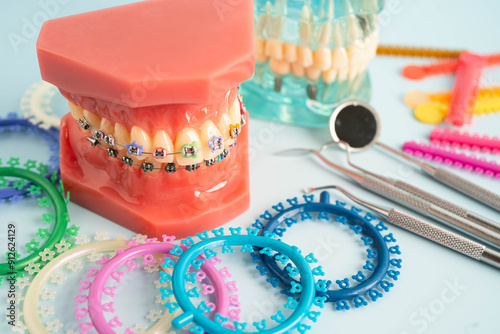 Orthodontic ligatures rings and ties, elastic rubber bands on orthodontic braces, model for dentist studying about dentistry. photo