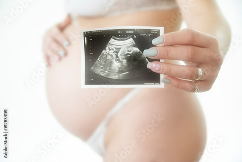 woman showing ultrasound of their baby photo