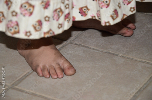 Canvastavla Child , girl in a white dress with an owl print, bare feet on the stone floor, with the insteps, toes and soles very dirty, black with asphalt dust