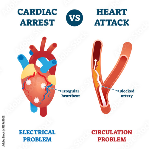 Cardiac arrest vs heart attack illustration, transparent background. Labeled health problems comparison - electrical or circulation caused. Medical educational sick organ failure diagnosis scheme.