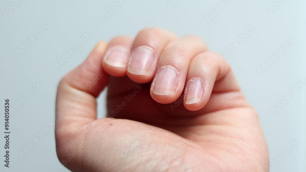 A detailed close up of a hand showing natural fingernails without a manicure A detailed close up of a hand showing natural fingernails without a manicure