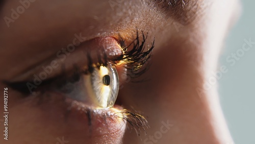 Beautiful female eye with yellow laser ray. Vision correction surgery on female eye. In a modern ophthalmology operating room, a patient is prepared for surgery. The concept of modern technologies