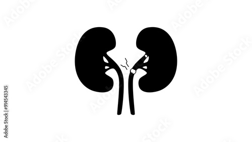 kidney stones, black isolated silhouette